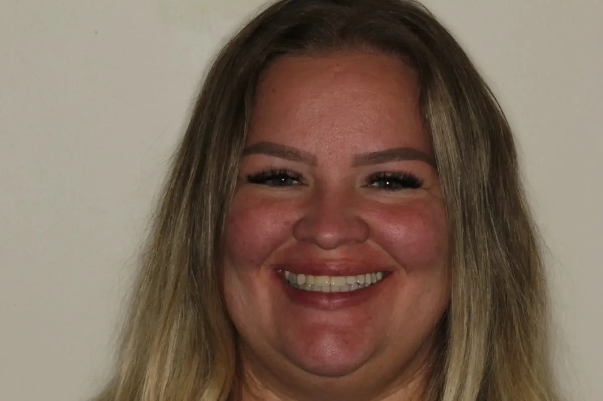 Catherine before smile makeover — discolored mismatched teeth with old composite build-ups