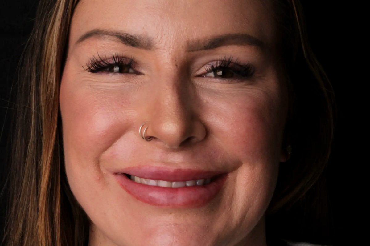 Cory's Case before veneers