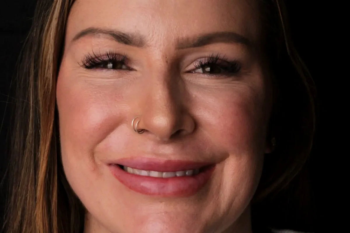 Cory before porcelain veneers