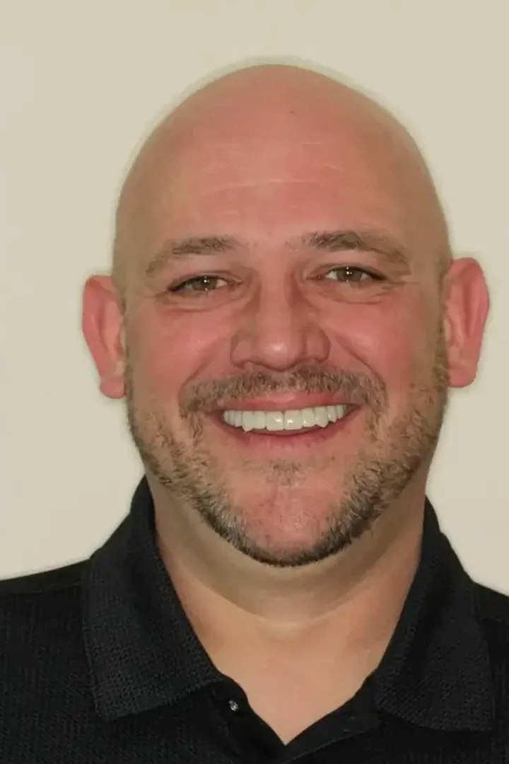 David after mixed restorative smile treatment