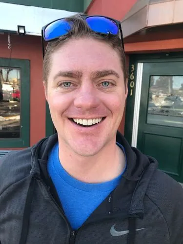 Natural smile after porcelain veneers — real world result of full mouth E.max restoration