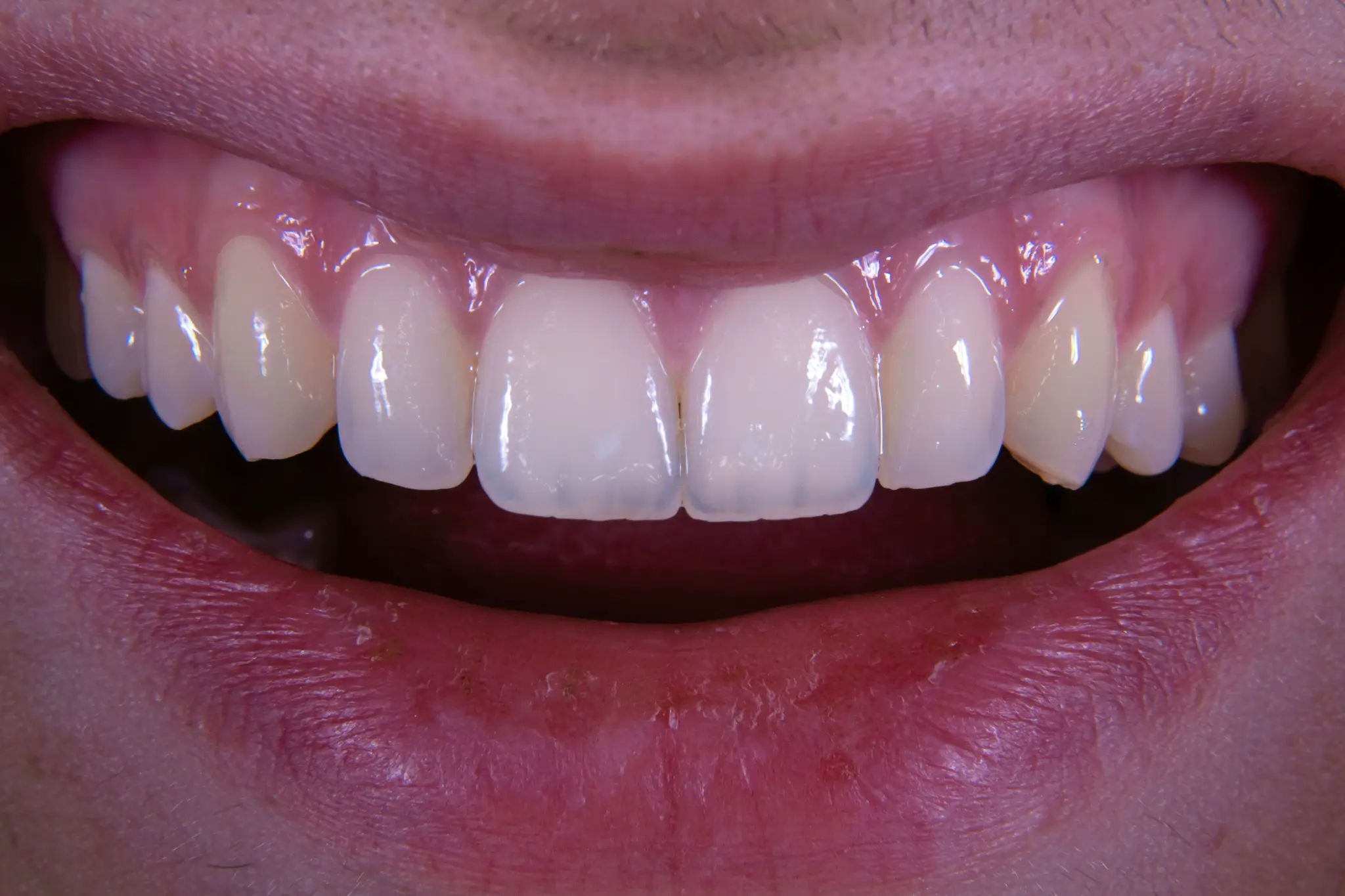 Woman with a confident, beautiful smile